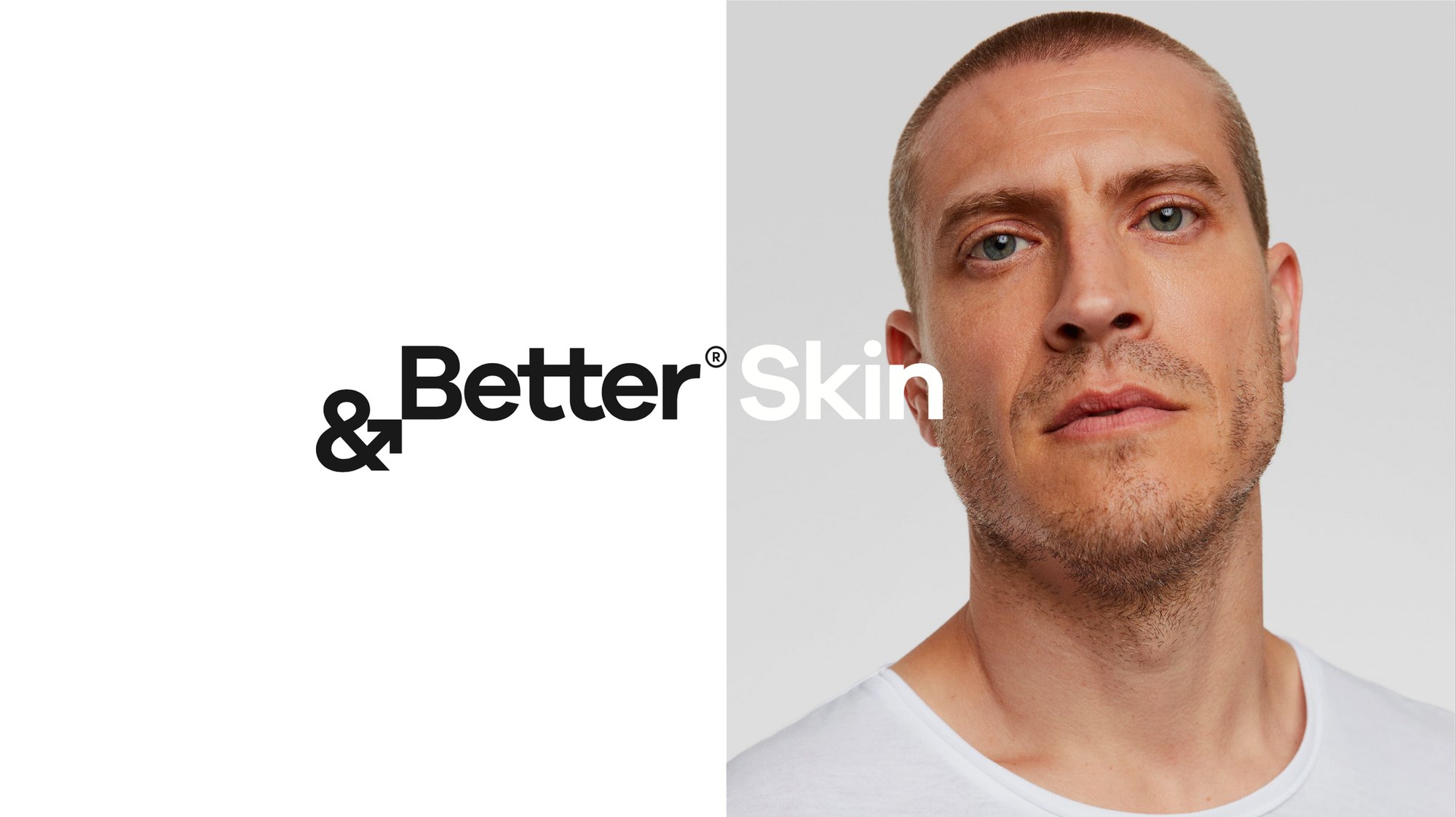 &Better Skin